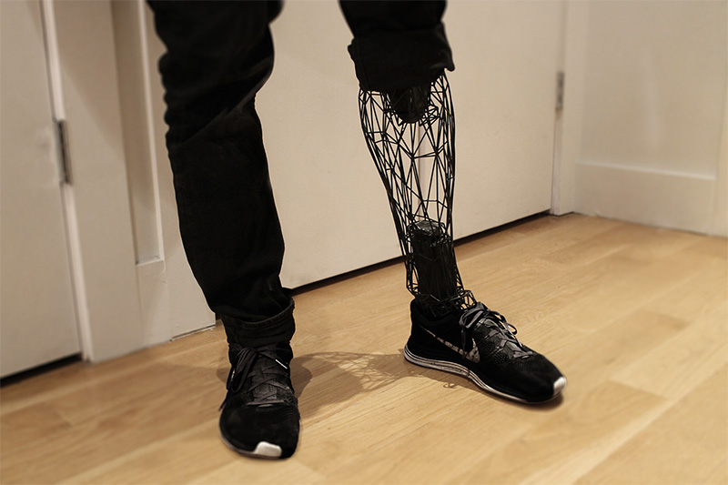 3D-Printed Prosthetic Limbs The Next Revolution In Medicine  - The Next Revolution In Medicine.